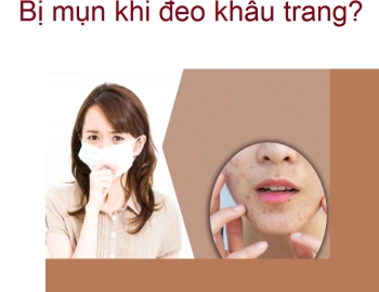 Đeo khẩu trang bị mụn: Nguyên nhân và cách khắc phục