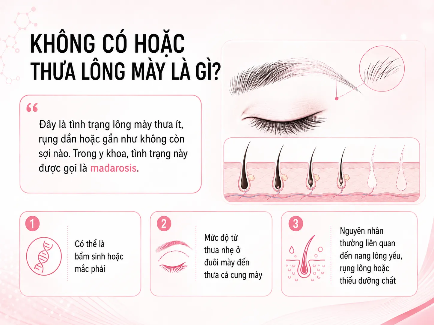 Không có hoặc thưa lông mày là tình trạng như thế nào?