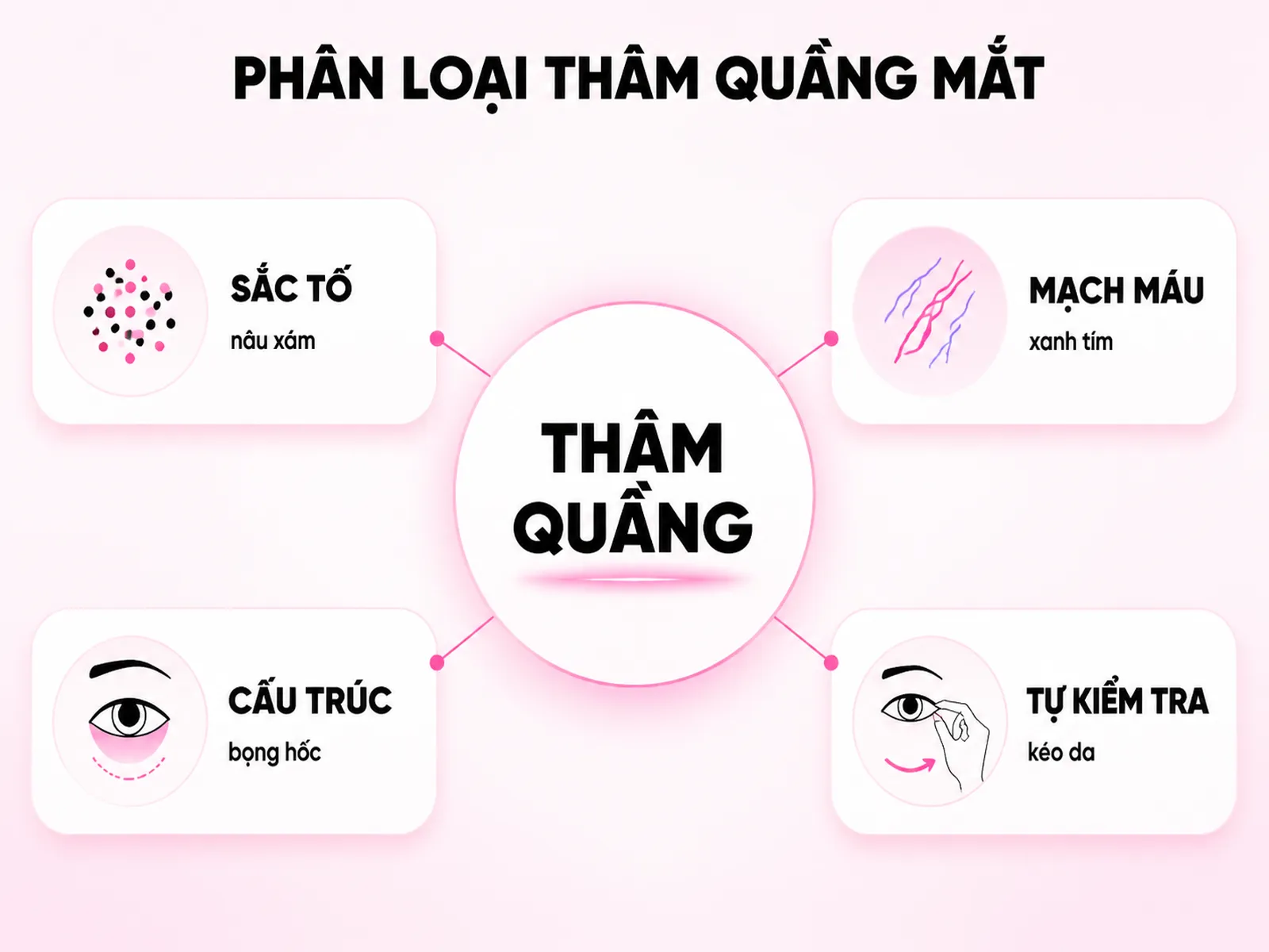 Thâm quầng mắt của bạn thuộc loại nào? Ba nguyên nhân chính