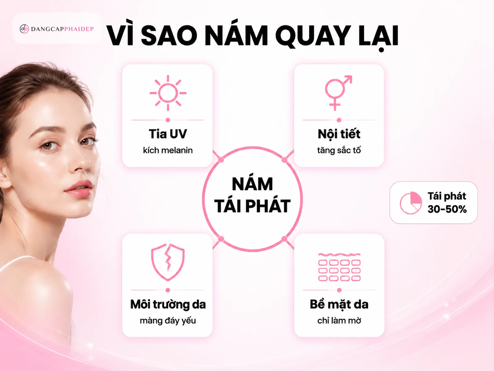 Sơ đồ nguyên nhân nám tái phát: tia UV, nội tiết, vi môi trường da và điều trị chỉ bề mặt