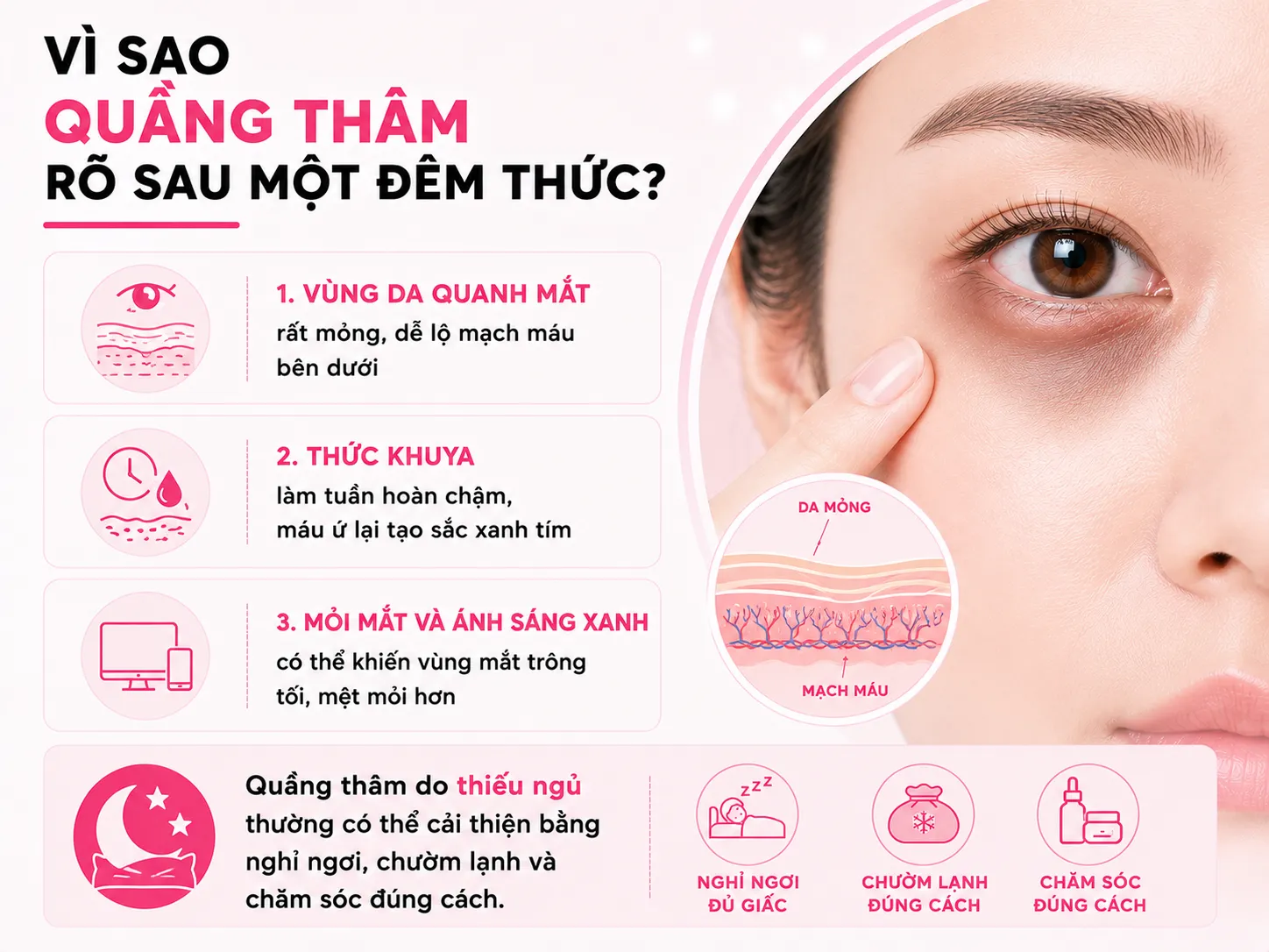 Vì sao quầng thâm hiện rõ chỉ sau một đêm thức?