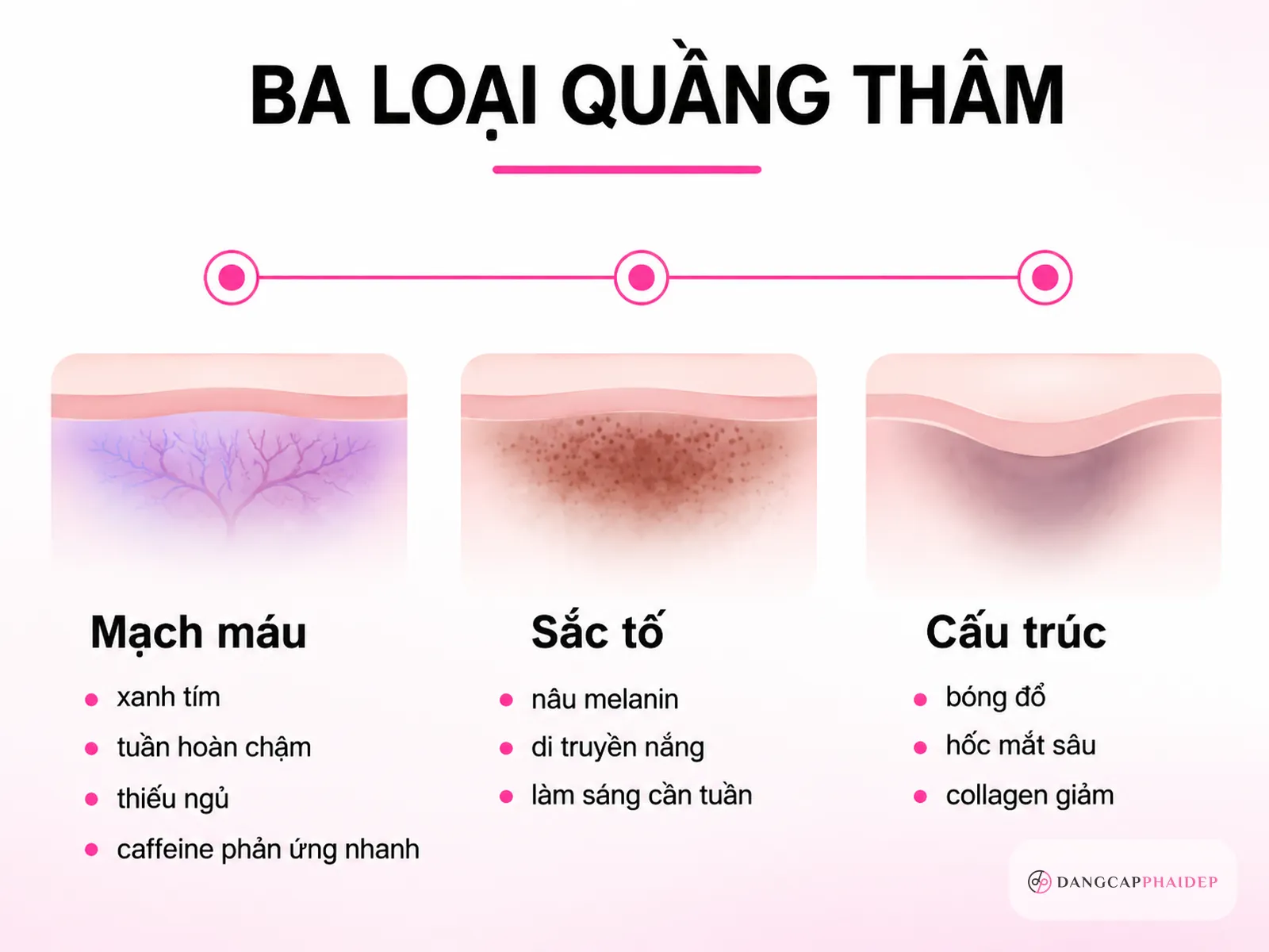 Ba loại quầng thâm và cách nhận biết loại của bạn