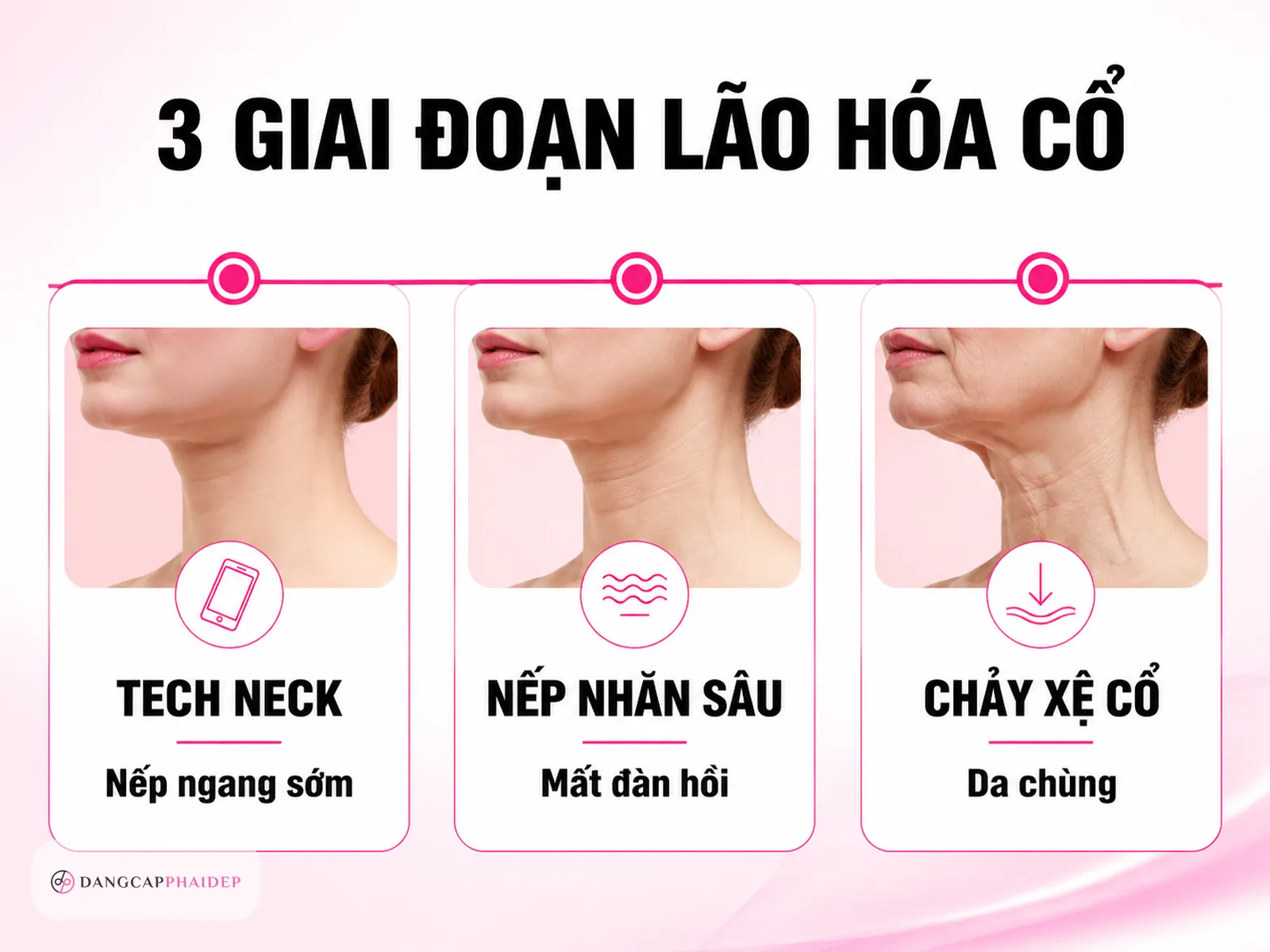 Nhận diện 3 giai đoạn lão hóa vùng cổ: bạn đang ở đâu?
