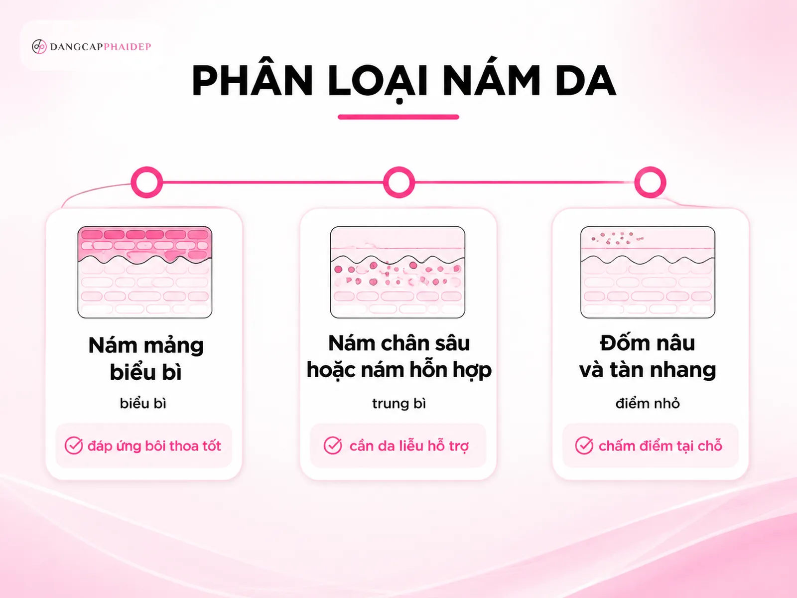 02-phan-loai-nam-ban-dang-gap-loai-nao