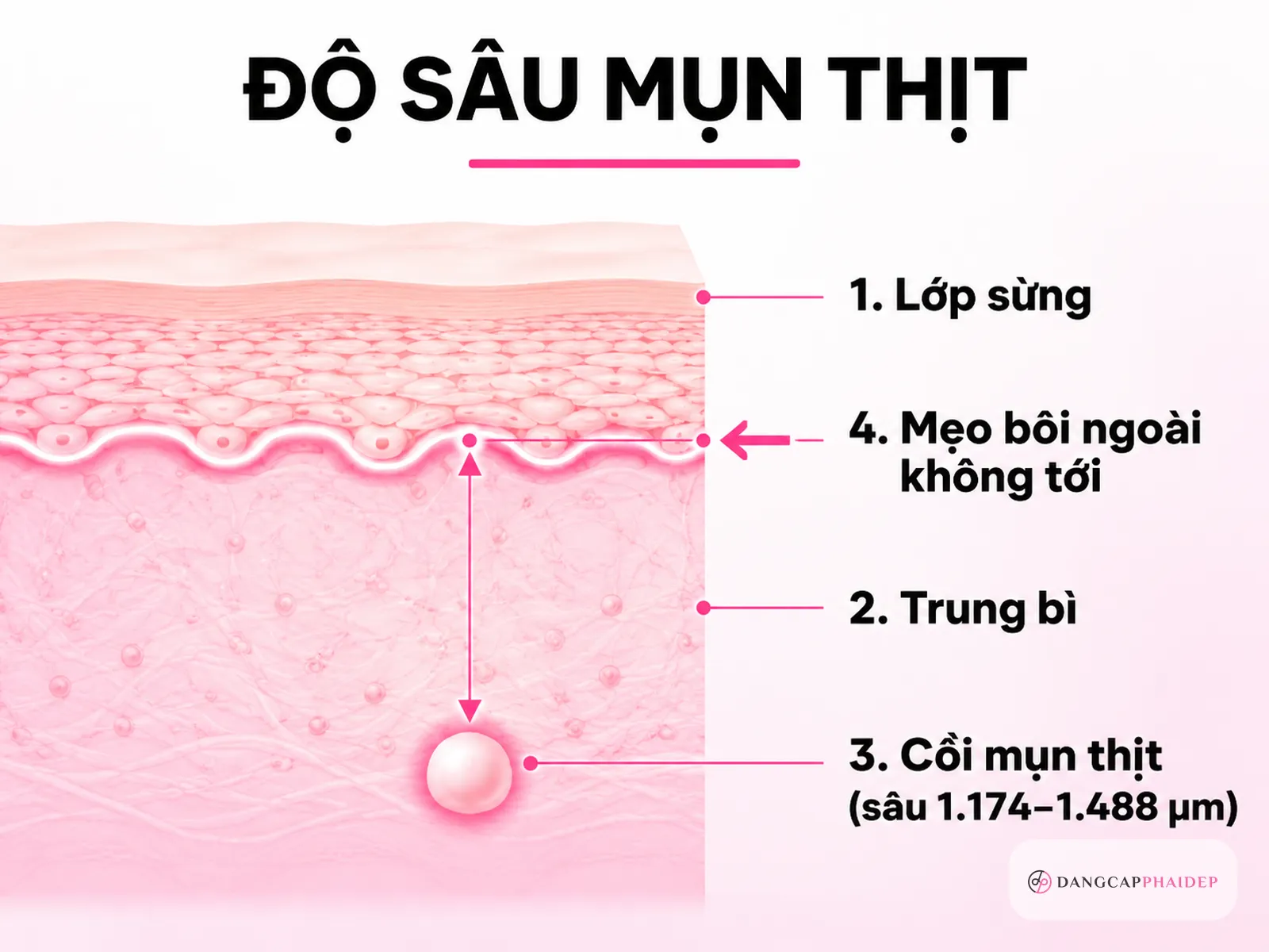 Vì sao bôi tỏi, tía tô mãi mà nốt mụn thịt vẫn không biến mất