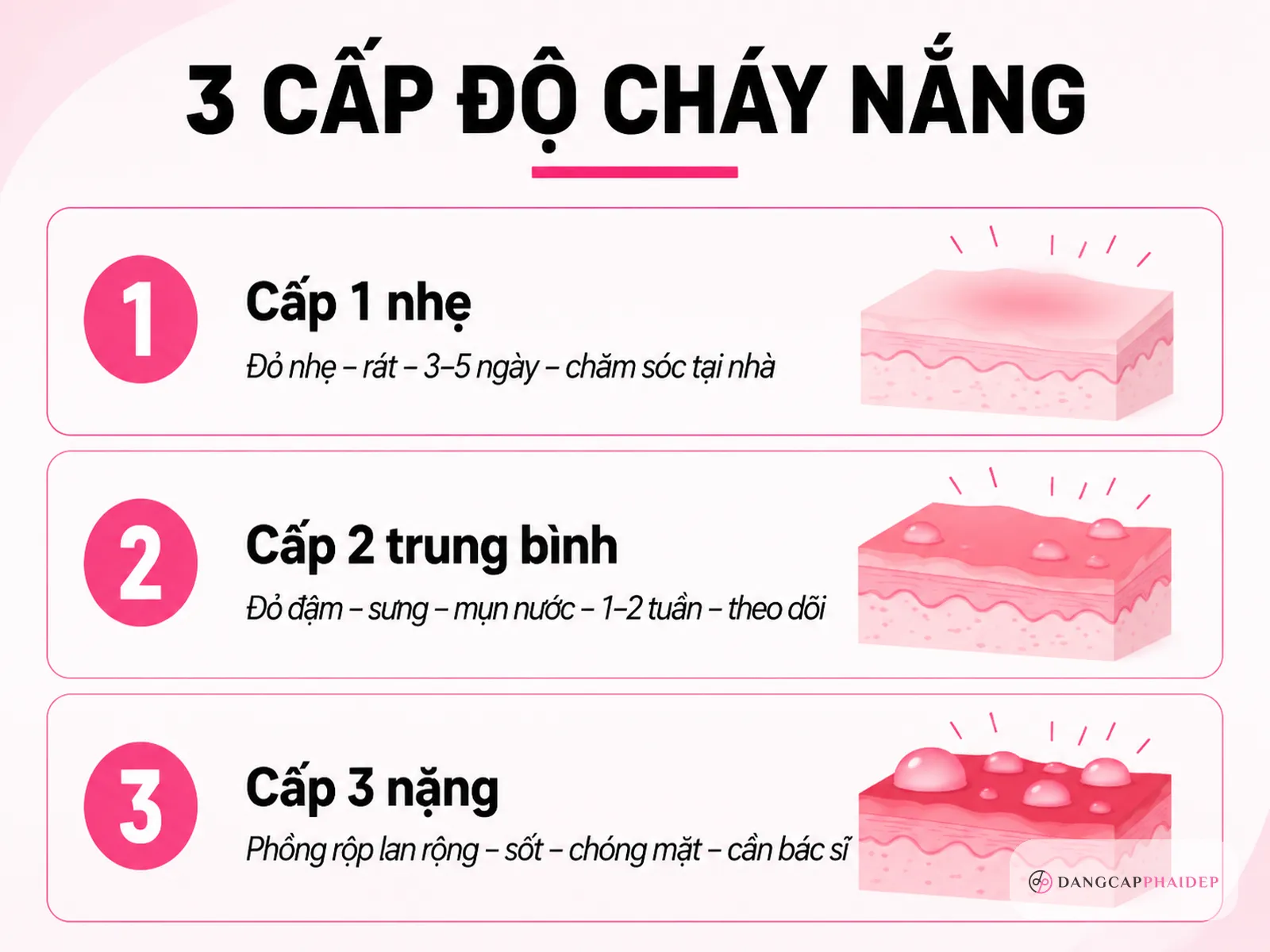 Bạn đang ở cấp độ nào? Bảng tự nhận biết 3 cấp độ cháy nắng