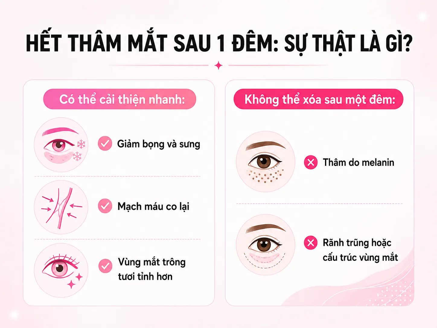 Infographic phân biệt bọng mắt giảm nhanh và sắc tố thâm mắt cần thời gian