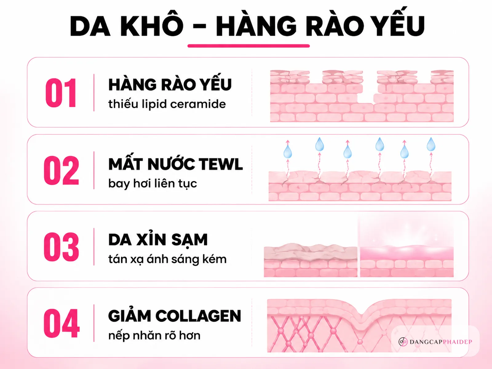 Infographic giải thích vì sao da khô dễ lão hóa, mất nước và sạm nám