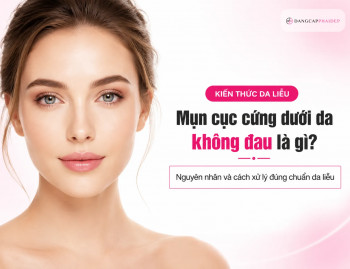 Mụn cục cứng dưới da không đau là gì? Nguyên nhân và cách xử lý đúng chuẩn da liễu