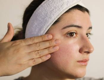 Peel da bị đỏ: Tác dụng phụ sau khi peel và cách phục hồi da