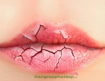 Cách để chăm sóc môi của bạn tránh khỏi những dấu hiệu lão hóa