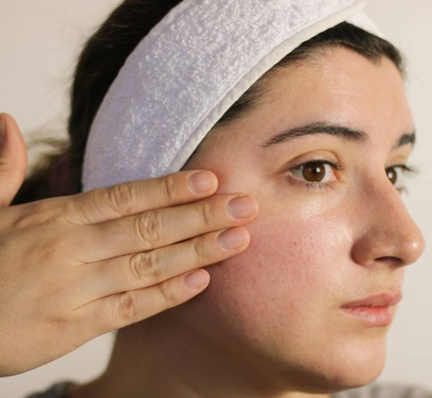 Peel da bị đỏ: Tác dụng phụ sau khi peel và cách phục hồi da