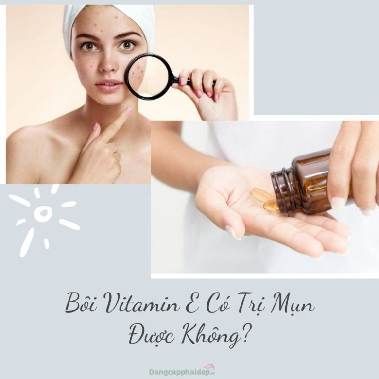 Bí quyết cách dùng vitamin e trị mụn cho làn da sạch mụn