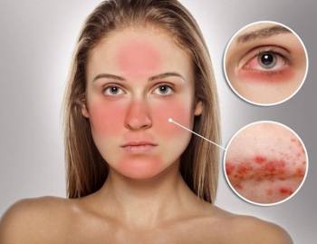 Thêm review chứng tỏ Be - Max The Sun là “cứu tinh” cho mọi loại da khỏi tác hại của tia cực tím