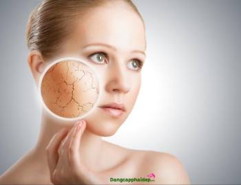 Tips cải thiện da khô và ngăn ngừa hình thành nếp nhăn