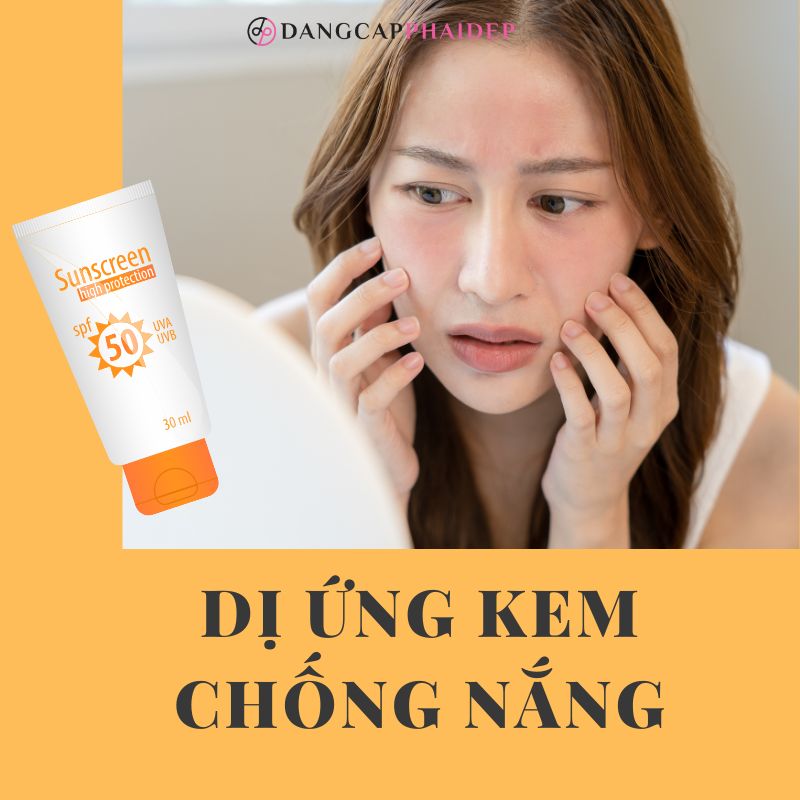 Có cách nào để xử lý khi bị dị ứng kem chống nắng mà không cần thăm khám bác sĩ?
