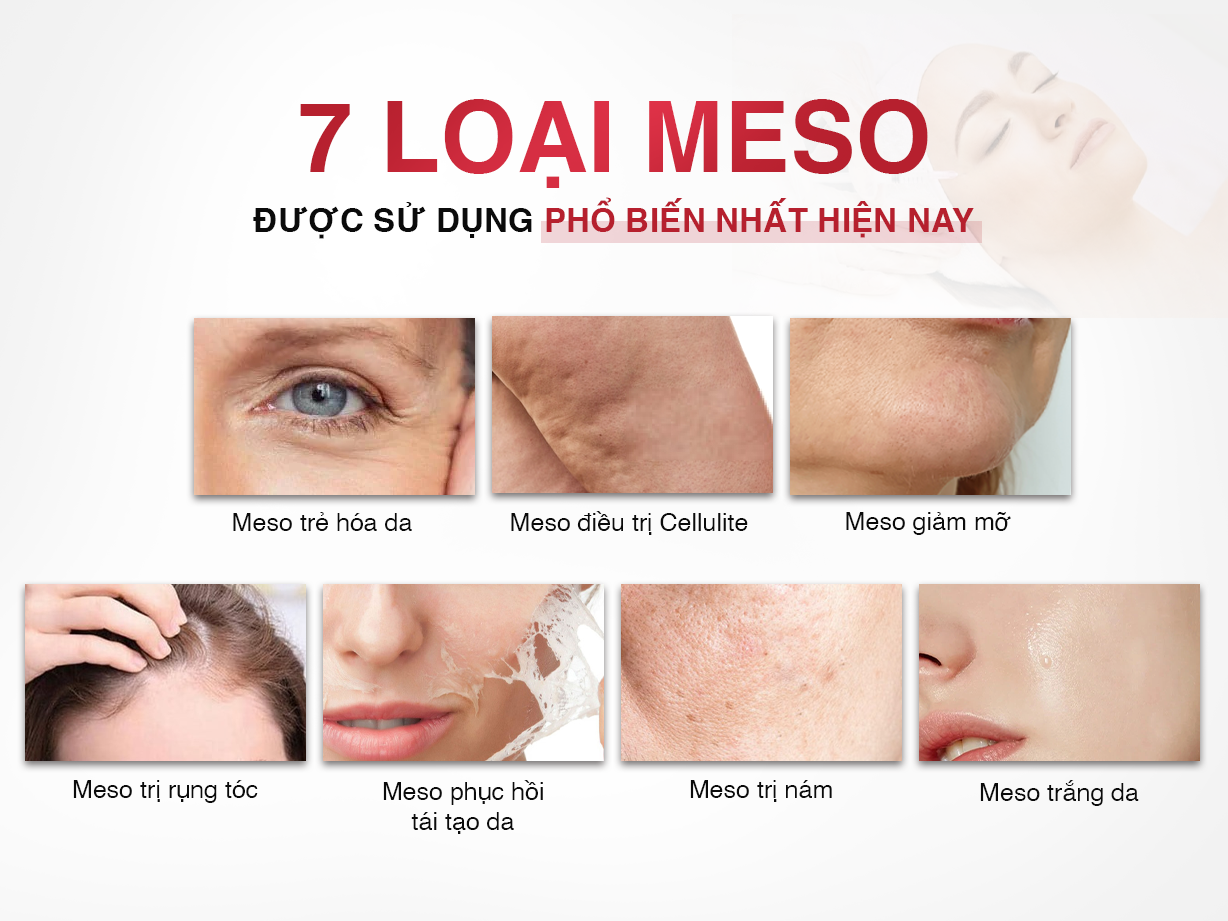 Các loại meso phổ biến hiện nay