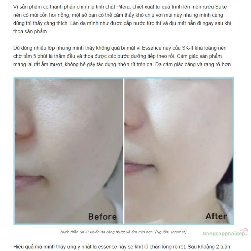 Nước thần SK-II Facial Treatment Essence Chống Lão Hóa 230ml
