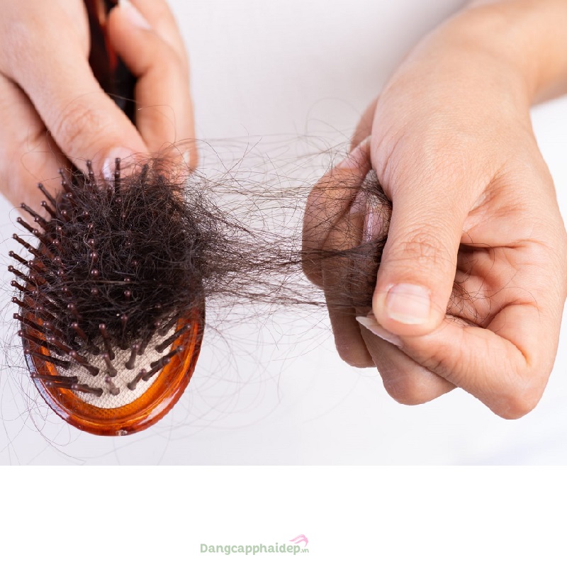 Viên uống giảm rụng tóc Martiderm Hair System Anti Hair-Loss Capsules 60  viên