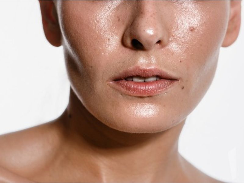 Loại da là một trong các yếu tố ảnh hưởng đến tần suất peel da