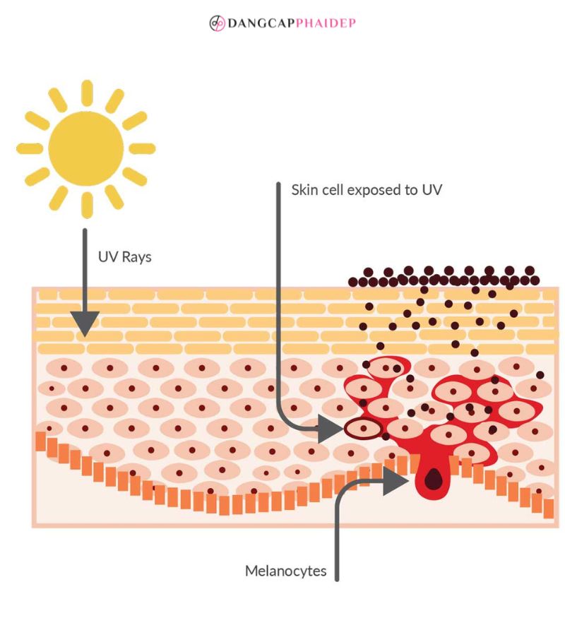 Khi da tiếp xúc với ánh nắng, hắc tố sản sinh ra hắc tố để bảo vệ da, da càng trắng thì càng dễ bắt nắng và đen sạm.