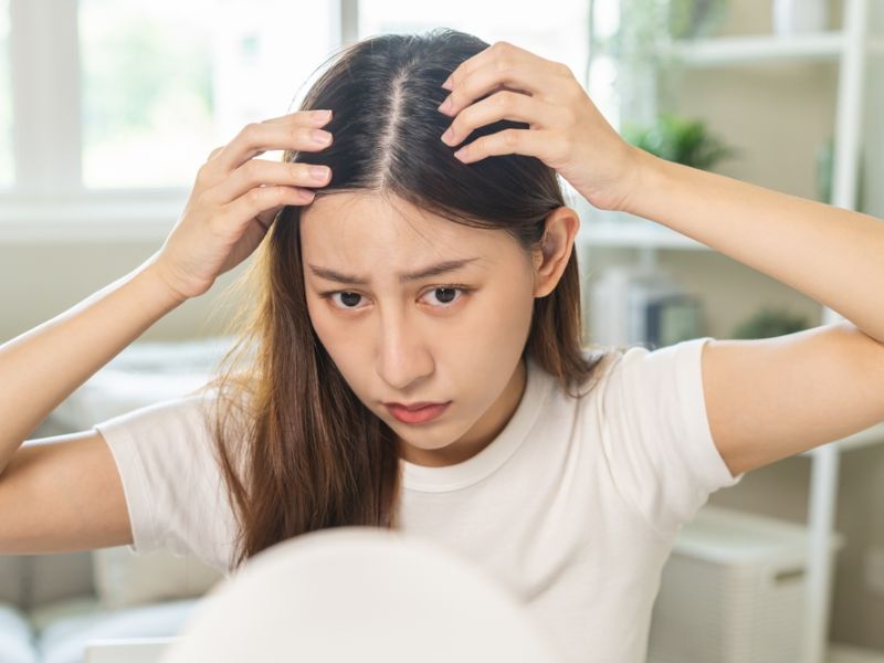 Các triệu chứng của gàu và da đầu khô