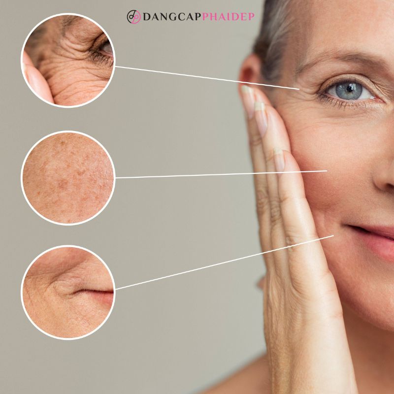 Kem chống nắng hỗ trợ ngăn ngừa các dấu hiệu lão hóa sớm trên da.