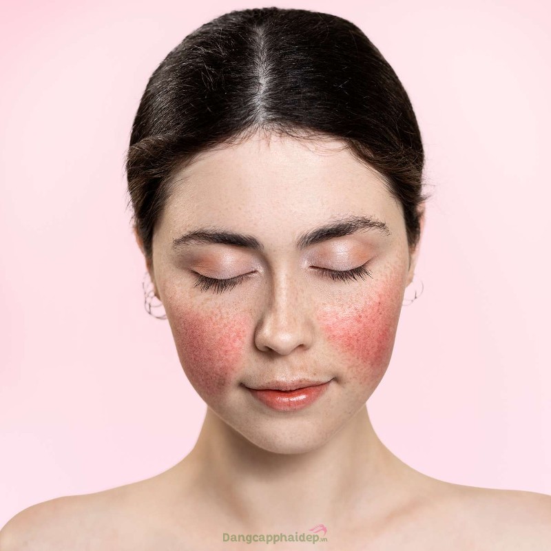 Germaine De Capuccini So Delicate SOS D-Sensitizing Facial Serum “tiễn bay” sự nhạy cảm của da.