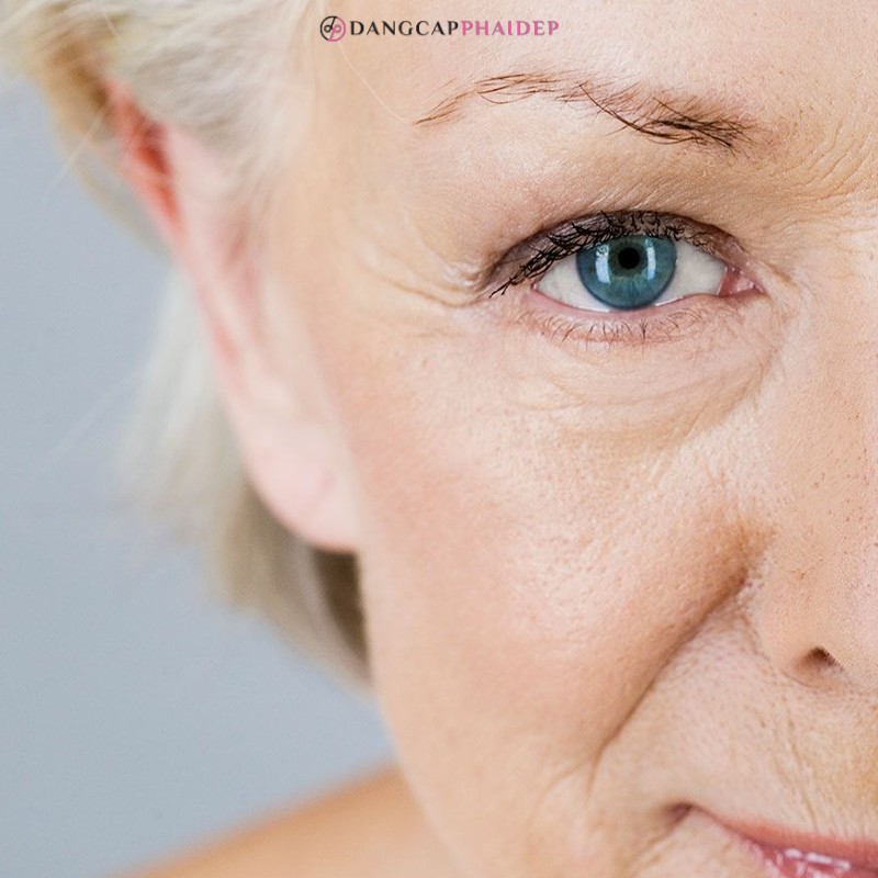  Infini Premium Meso Eyebooster xóa mờ mọi dấu hiệu lão hóa vùng mắt.