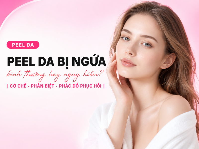 Peel da bị ngứa: Nguyên nhân, cách phân biệt mức độ và phác đồ phục hồi theo từng giai đoạn