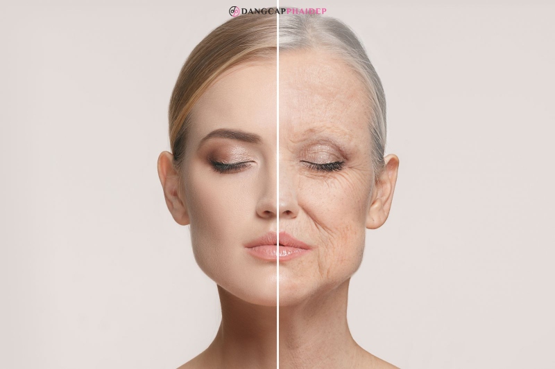 Da bắt đầu xuất hiện dấu hiệu lão hóa là dấu hiệu thiếu hụt collagen.