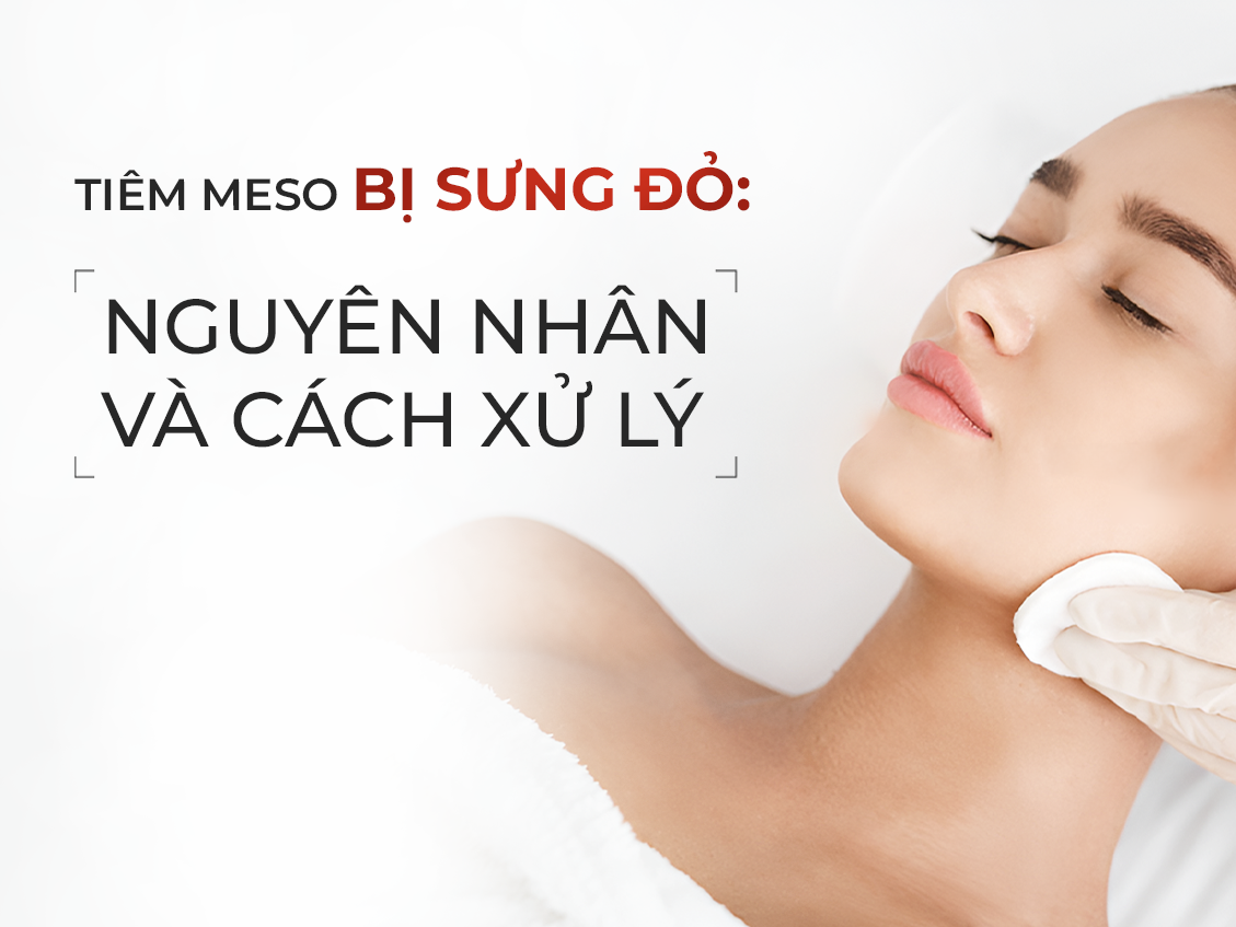 Tiêm meso bị sưng đỏ: Nguyên nhân và cách xử lý