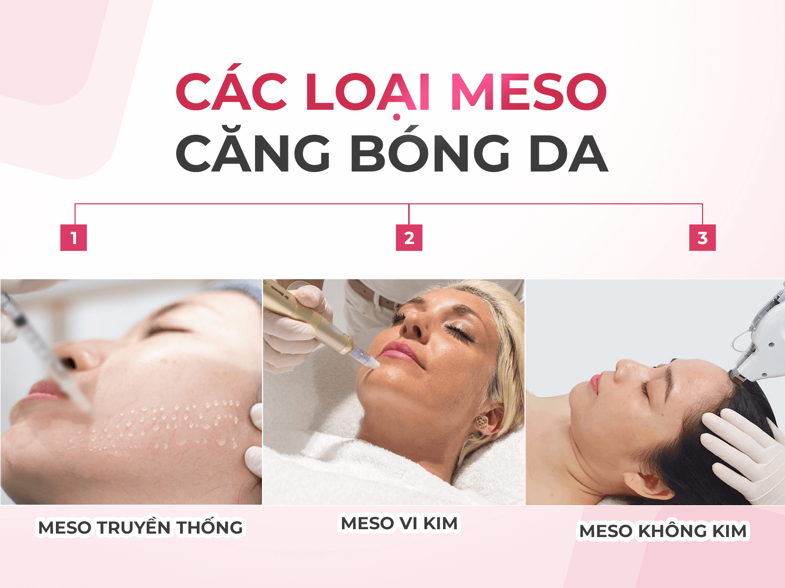 Các loại meso căng bóng da