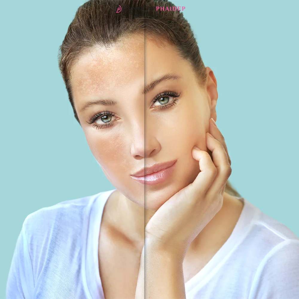 Zo Skin Health Brightalive Skin Brightener loại bỏ khuyết điểm trên gương mặt.